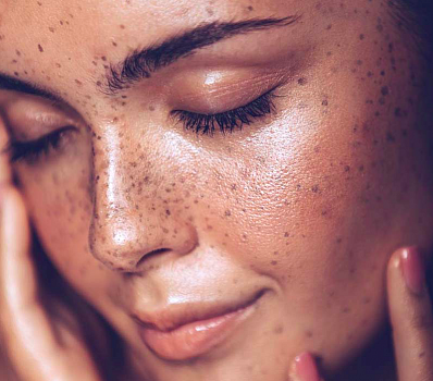5 вещей, которые делают вашу кожу тусклой